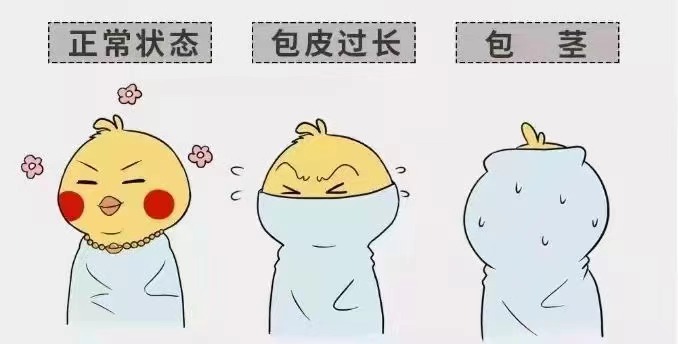 齐齐哈尔包皮包茎MK官网